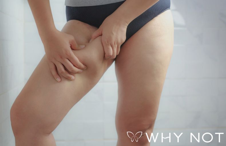 「脚だけ太い」「くびれがない」の本当の原因。自己流ダイエットで部分痩せが難しい理由